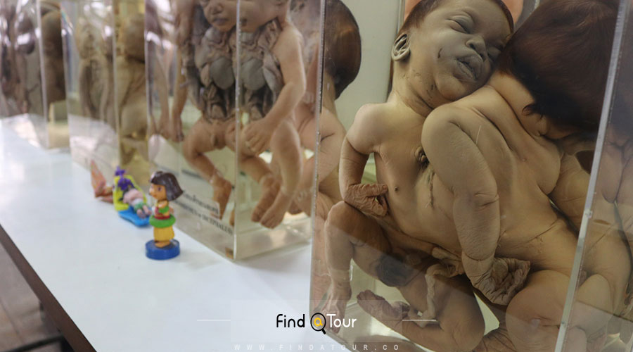 موزه بدن انسان یا موزه آناتومی تایلند